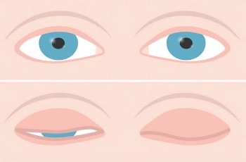 Câu chuyện về con mắt !